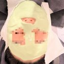 뷰티온의원 파주운정점 내돈내산 시술후기