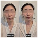 언제나 지금처럼 | [리뷰] 울산 윤곽관리 피부관리맛집 '언제나 지금처럼'