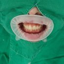 치아사랑치과기공소 | 구리 안창동 치과에서 단 2회만에 자신있는 미소 완성 (ft.치아미백 후기와 추천)