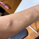 (야간)직장인을 위한 민화 | 직장인을 위한 야간혈액투석 후기 및 비용 – 송파구 문정동 고은내과 첫투석 경험 공유