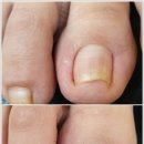 아우룸네일 이미지