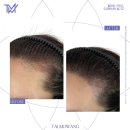 탈모왕 광주점 이미지