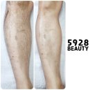 5928뷰티 이미지
