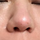 뷰티데이, 경남 양산 미주안, 엑소좀, 매화약침 한방 피부시술별 솔직한 효과 비교! (ft. 다이소 뷰티템...
