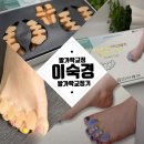 귀족미가 | 발가락운동기구 [이숙경발가락교정기] 30대 발관리 착용 후기