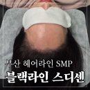 탑마트 사거리 앞2 | 블랙라인 X 스디센부산 헤어라인 SMP 2회차 완성후기