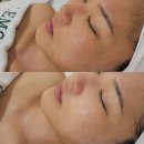 레몬트리 | 남천동 에스테틱 레몬트리에스테틱, 1:1 맞춤 피부 관리 솔직 후기