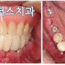 리더스치과기공소 이미지