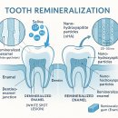 중화다인치과의원 | 1000, 1450ppm? 고불소 치약을 써야하는 진짜 이유[광교신도시, 상현역 치과]