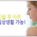 수유역 피부과:팔자주름필러로 깊게 자리잡은 주름을 없애볼까? 이미지