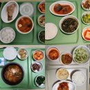 11650-16-167-7 | 두개골조기유합증(우측관상봉합,167일아기:5개월)신연기 제거수술 후기(서울아산병원 소아신경외과)