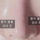 준메디케어 이미지