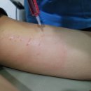 아이미의원 | ::아이미클리닉:: S슬림빨간주사 이대 아이미클리닉에서 받앗어요! (1회차) / 다이어트 후기