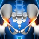 압구정노트정형외과의원 이미지