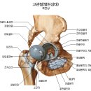 [고관절] 고관절이 틀어지는 원리 이미지