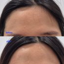 아크로타워 우체국 | 창원 왁싱샵 상남동 원드뷰티, 헤어라인 왁싱 후기