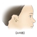 히어링굳보청기센터