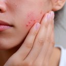 엘한의원 이미지