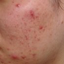 예한의원 이미지