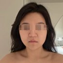 (주)우리파코미 | 강서윤곽관리 작은얼굴 만들기 :: 마곡 오브미에스테틱 두상관리 10회권 내돈내산 후기 및 효과 비교