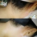 평택왁싱샵 도로시왁싱&amp;뷰티 헤어라인 정리 만족 후기