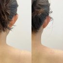 수성구에스테틱 자연을닮은피부관리실 솔직후기