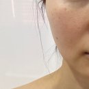 월서중학교 | 대구신부관리 알테온 얼굴리프팅 타이트닝 후기