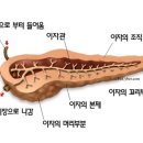 가장 무서운 암은 췌장암 이미지