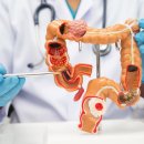 젊은층 대장암 급증…전문의가 꼽은 ‘치명적 실수 5가지’[건강팩트체크] 이미지