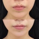 마린시티1로 | 해운대윤곽관리 잘하는 곳 찾는다면? 센텀피부관리 에스테티아 마린시티점 후기