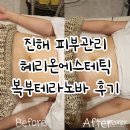 안청남로-1 | 진해피부관리 혜리온에스테틱 복부테라노바 &amp; 턱선리프팅 후기