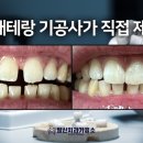 스타일치과기공소 이미지