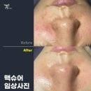 더맑은스킨(매곡점)