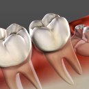 서울턱사랑니치과의원 이미지