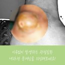 여러분소통내과의원 네이버블로그