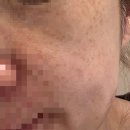 아이엠피부과의원 이미지