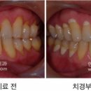 상아치과재료 이미지