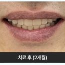 나비치과기공소 이미지