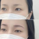 흥미 헤어라인 | 창원헤어라인 자연스러운 밀도감을 찾다, 비비드아트 창원점 방문 후기