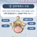 튼튼한한의원 네이버블로그