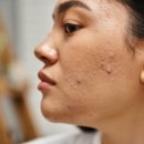 아젤리아 이미지