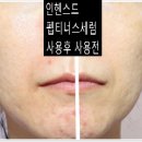 펩티너스