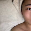 하나약국 | 신천동 스킨포시즌에서 퍼스널케어 문제성피부관리받은 후기