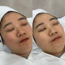 이엔뷰티 | (군산에스테틱) 군산피부관리하면 &#34;이엔뷰티&#34; 저온플라즈마로 여드름부터 모공관리까지!