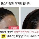 스타헤어라인 네이버블로그