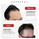 헤드샷스칼프본점 이미지