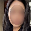 튠앤톤의원 | 얼굴형 관리로 좋은 통증 없는 티타늄리프팅과 튠라이너 효과 후기