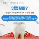사수동치과 잇몸치료 과정과 비용 정리