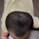 크리에이티브빌딩 | [단두 두상교정 #1] 8개월 아기 두상 교정 시작: 큰솔1병원, 지오크리에이티브 부산 방문 후기