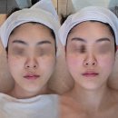 메디케어 | 광주 첨단 윤곽관리 부종관리 최고 레아쥬테라피 후기 메디케어스킨앤바디 광주첨단점